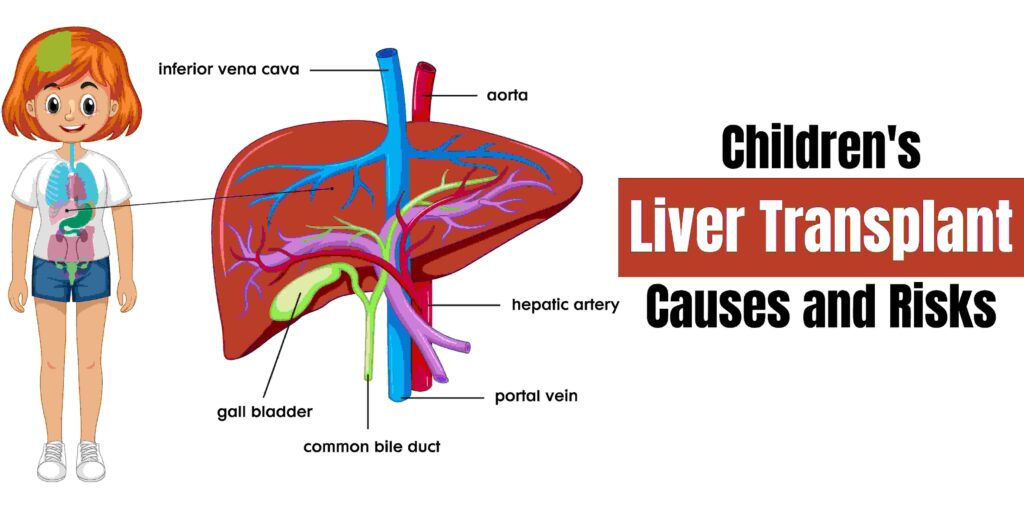 Children’s Liver Transplant Causes and Risks